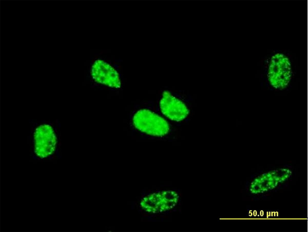 RBBP6 Antibody - Immunofluorescence of monoclonal antibody to RBBP6 on HeLa cell. [antibody concentration 10 ug/ml].