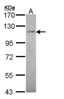 RBBP8 / CTIP Antibody - Sample (30 ug of whole cell lysate). A: Hep G2. 7.5% SDS PAGE. RBBP8 antibody diluted at 1:5000. 