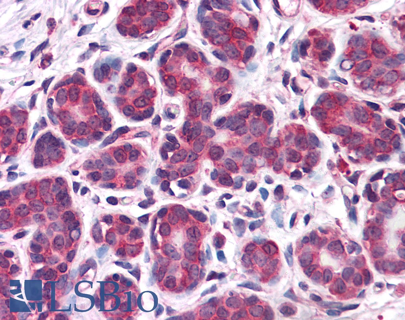RBBP8 / CTIP Antibody - Anti-RBBP8 / CTIP antibody IHC of human breast. Immunohistochemistry of formalin-fixed, paraffin-embedded tissue after heat-induced antigen retrieval. Antibody concentration 10 ug/ml.