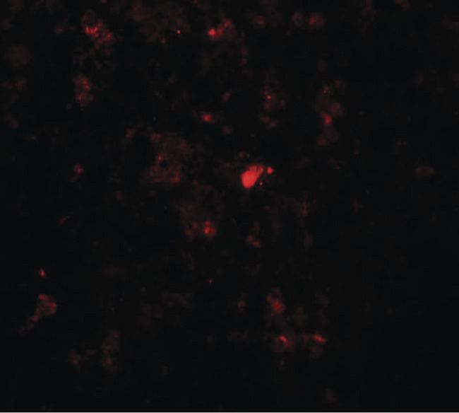 RBBP8 / CTIP Antibody - Immunofluorescence of RBBP8 in rat spleen tissue with RBBP8 antibody at 20 ug/ml.