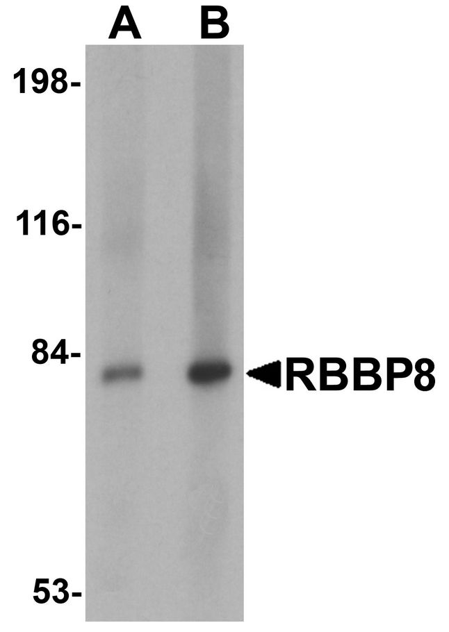 RBBP8 / CTIP Antibody - Western blot analysis of RBBP8 in mouse spleen tissue lysate with RBBP8 antibody at (A) 1 and (B) 2 ug/ml.