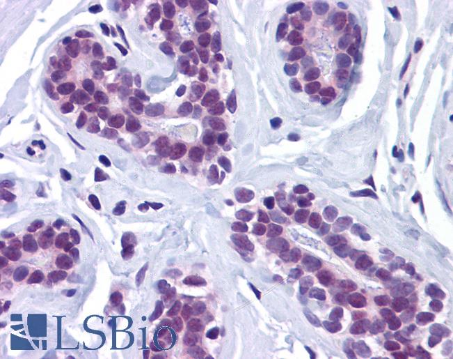 RBBP8 / CTIP Antibody - Anti-RBBP8 / CTIP antibody IHC of human breast. Immunohistochemistry of formalin-fixed, paraffin-embedded tissue after heat-induced antigen retrieval. Antibody concentration 5 ug/ml.