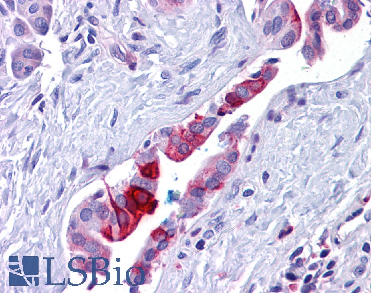 RBBP8 / CTIP Antibody - Anti-RBBP8 / CTIP antibody IHC of human pancreas, duct. Immunohistochemistry of formalin-fixed, paraffin-embedded tissue after heat-induced antigen retrieval. Antibody concentration 5 ug/ml.