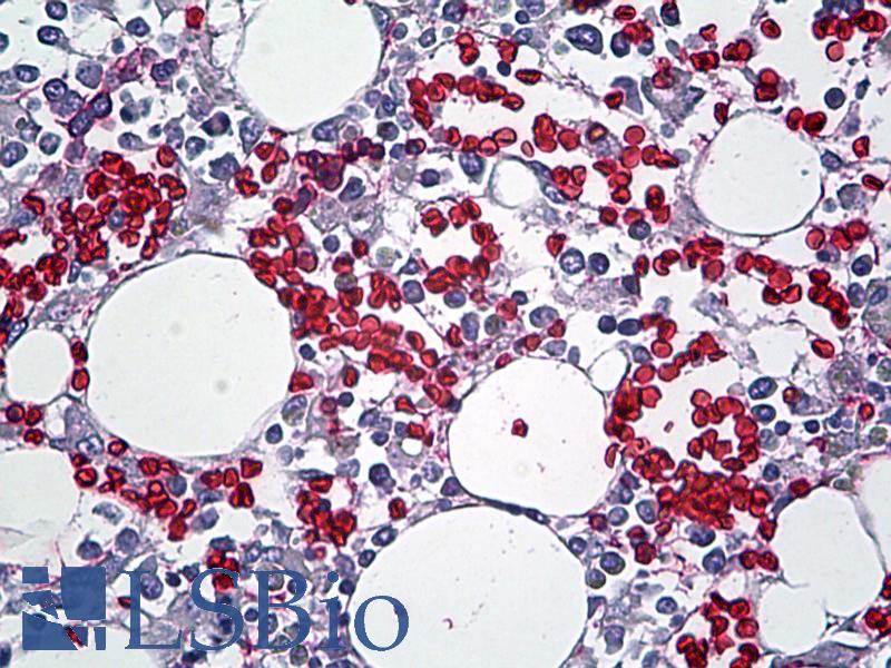 RBC / Red Blood Cells Antibody - Anti-RBC / Red Blood Cells antibody IHC of human bone marrow. Immunohistochemistry of formalin-fixed, paraffin-embedded tissue after heat-induced antigen retrieval. Antibody dilution 1:100.