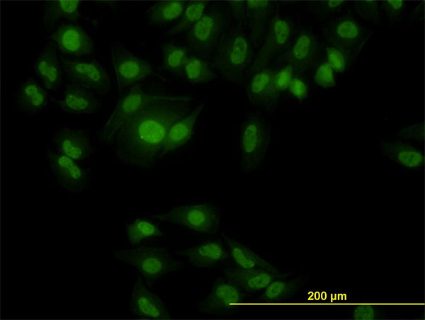 RBFOX2 / RBM9 Antibody - Immunofluorescence of monoclonal antibody to RBM9 on HeLa cell. [antibody concentration 10 ug/ml]
