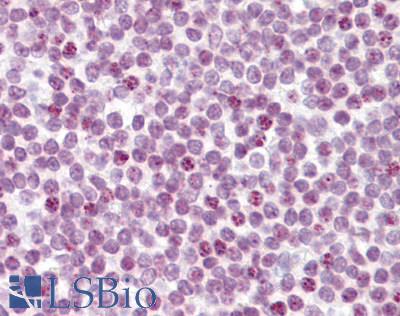 RBL2 / RB2 p130 Antibody - Anti-RB2 antibody IHC of human tonsil. Immunohistochemistry of formalin-fixed, paraffin-embedded tissue after heat-induced antigen retrieval. Antibody dilution 1:200.