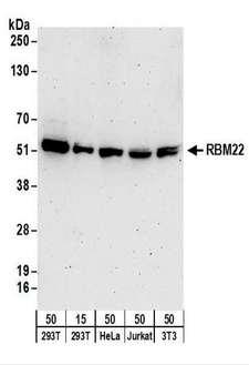 RBM22 Antibody - Detection of Human and Mouse RBM22 by Western Blot. Samples: Whole cell lysate from 293T (15 and 50 ug), HeLa (50 ug), Jurkat (50 ug), and mouse NIH3T3 (50 ug) cells. Antibodies: Affinity purified rabbit anti-RBM22 antibody used for WB at 0.1 ug/ml. Detection: Chemiluminescence with an exposure time of 3 minutes.