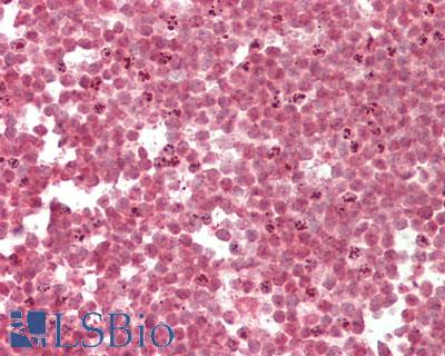 RBM22 Antibody - Human Colon, Lymphoid Aggregate: Formalin-Fixed, Paraffin-Embedded (FFPE)