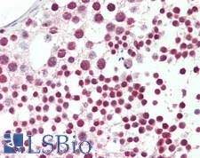 RBM23 Antibody - Human Testis: Formalin-Fixed, Paraffin-Embedded (FFPE)