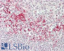 RBM25 / SNU71 Antibody - Human Spleen: Formalin-Fixed, Paraffin-Embedded (FFPE)