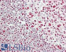 RBM25 / SNU71 Antibody - Human Spleen: Formalin-Fixed, Paraffin-Embedded (FFPE)