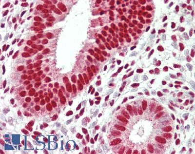 RBM25 / SNU71 Antibody - Human Uterus: Formalin-Fixed, Paraffin-Embedded (FFPE)