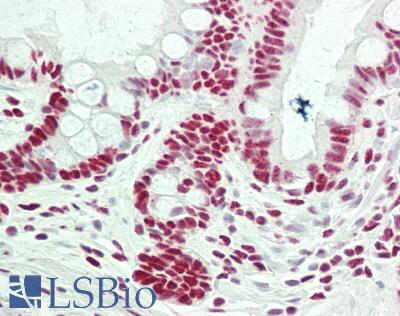 RBM25 / SNU71 Antibody - Human Small Intestine: Formalin-Fixed, Paraffin-Embedded (FFPE)