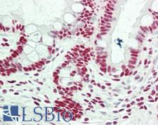 RBM25 / SNU71 Antibody - Human Small Intestine: Formalin-Fixed, Paraffin-Embedded (FFPE)