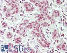 RBM26 / SE70 Antibody - Human Breast: Formalin-Fixed, Paraffin-Embedded (FFPE)