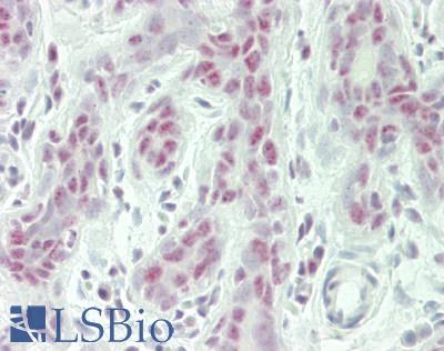 RBM26 / SE70 Antibody - Human Breast: Formalin-Fixed, Paraffin-Embedded (FFPE)