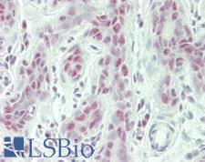 RBM26 / SE70 Antibody - Human Breast: Formalin-Fixed, Paraffin-Embedded (FFPE)