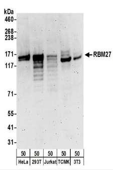 RBM27 Antibody - Detection of Human and Mouse RBM27 by Western Blot. Samples: Whole cell lysate (50 ug) from HeLa, 293T, Jurkat, mouse TCMK-1, and mouse NIH3T3 cells. Antibodies: Affinity purified rabbit anti-RBM27 antibody used for WB at 0.1 ug/ml. Detection: Chemiluminescence with an exposure time of 3 minutes.