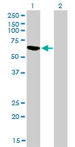 RBM5 / G15 Antibody - Western blot of RBM5 expression in transfected 293T cell line by RBM5 monoclonal antibody clone 2B6.