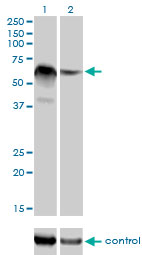 RBM5 / G15 Antibody - Western blot of RBM5 over-expressed 293 cell line, cotransfected with RBM5 Validated Chimera RNAi (Lane 2) or non-transfected control (Lane 1). Blot probed with RBM5 monoclonal antibody clone 2B6. GAPDH ( 36.1 kD ) used as specificity and.