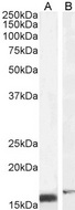 RBP1 / CRBP Antibody - RBP1 / CRBP antibody (2µg/ml) staining of NIH3T3 (A) and (0.5ug/ml) of U251 (B) cell lysate (35µg protein in RIPA buffer). Detected by chemiluminescence.
