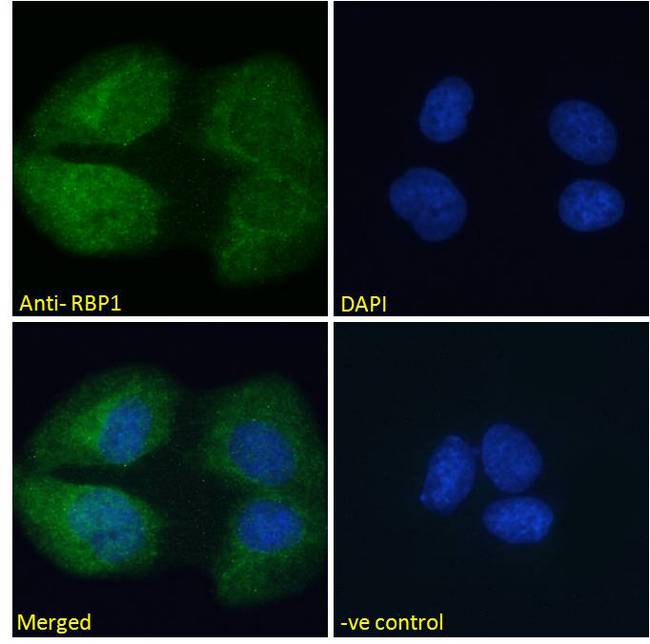 RBP1 / CRBP Antibody - RBP1 / CRBP antibody immunofluorescence analysis of paraformaldehyde fixed U2OS cells, permeabilized with 0.15% Triton. Primary incubation 1hr (10ug/ml) followed by Alexa Fluor 488 secondary antibody (2ug/ml), showing cytoplasmic and nuclear staining. The nuclear stain is DAPI (blue). Negative control: Unimmunized goat IgG (10ug/ml) followed by Alexa Fluor 488 secondary antibody (2ug/ml).