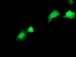 RBP1 / CRBP Antibody - Anti-RBP1 mouse monoclonal antibody immunofluorescent staining of COS7 cells transiently transfected by pCMV6-ENTRY RBP1.