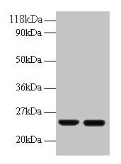 RBP4 Antibody - Western blot All lanes: human Retinol-binding protein 4 antibody at 2µg/ml + human positive serum Lane 1: positive serum at 1: 10 Lane 2: positive serum at 1: 100 Secondary Goat polyclonal to rabbit IgG at 1/50000 dilution Predicted band size: 22 kDa Observed band size: 22 kDa