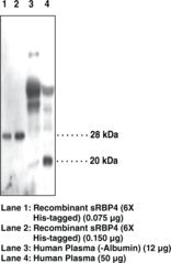 RBP4 Antibody - Western blot of RBP / RBP4 antibody.