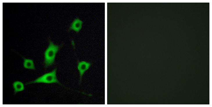 RBP5 Antibody - Immunofluorescence analysis of LOVO cells, using CRBP III Antibody. The picture on the right is blocked with the synthesized peptide.