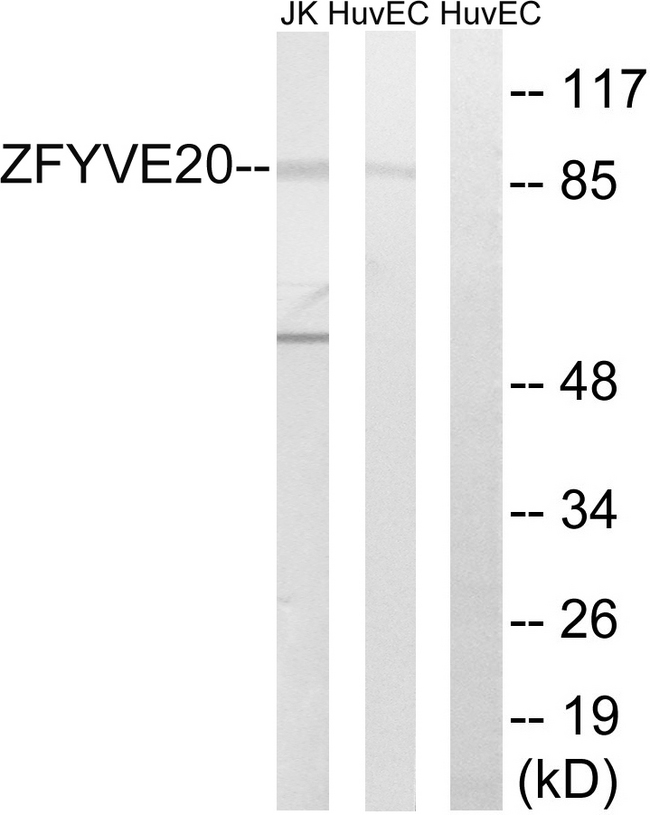 RBSN / Rabenosyn 5 Antibody - Western blot analysis of lysates from HUVEC and Jurkat cells, using ZFYVE20 Antibody. The lane on the right is blocked with the synthesized peptide.
