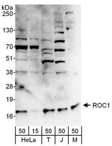 RBX1 / ROC1 Antibody - Detection of Human and Mouse ROC1 by Western Blot. Samples : Whole cell lysate from HeLa (15 and 50 ug), 293T (T; 50 ug), Jurkat (J; 50 ug) and mouse NIH3T3 (M; 50 ug) cells. Antibody : Affinity purified rabbit anti-ROC1 antibody used for WB at 0.1 ug/ml. Detection: Chemiluminescence with an exposure time of 3 minutes.