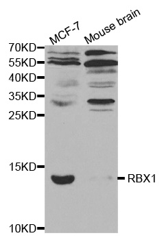 RBX1 / ROC1 Antibody - Western blot analysis of extracts of various cell lines, using RBX1 antibody.