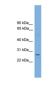 RCAN1 / DSCR1 Antibody - RCAN1 antibody western blot of human placenta lysate.  This image was taken for the unconjugated form of this product. Other forms have not been tested.