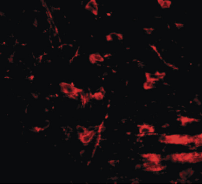 RCAN2 / RCN2 Antibody - Immunofluorescence of RCAN2 in mouse brain tissue with RCAN2 antibody at 20 ug/ml.