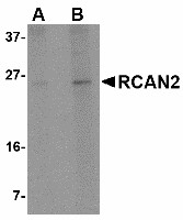 RCAN2 / RCN2 Antibody - Western blot of RCAN2 in 3T3 cell lysate with RCAN2 antibody at (A) 1 and (B) 2 ug/ml.