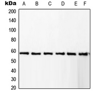 RCBTB1 Antibody - Western blot analysis of RCBTB1 expression in KNRK (A); Jurkat (B); A431 (C); HeLa (D); Raw264.7 (E); NIH3T3 (F) whole cell lysates.