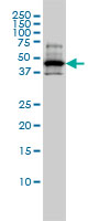 RCC1 Antibody - Western blot of RCC1 expression in A-431 cell lysate.