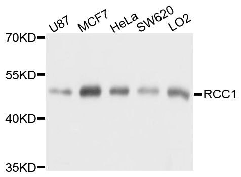 RCC1 Antibody - Western blot analysis using RCC1 antibody.