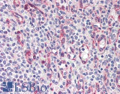 RCD1 / RQCD1 Antibody - Human Spleen: Formalin-Fixed, Paraffin-Embedded (FFPE), at a concentration of 10 ug/ml.