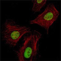 RCHY1 / PIRH2 Antibody - Immunofluorescence of HeLa cells using Pirh2 mouse monoclonal antibody (green). Red: Actin filaments have been labeled with Alexa Fluor-555 phalloidin.
