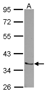 RCHY1 / PIRH2 Antibody - Sample (30 ug of whole cell lysate) A: NT2D1 10% SDS PAGE RCHY1 / PIRH2 antibody diluted at 1:1000