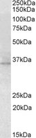 RDH1 / RDH5 Antibody - RDH5 antibody (2 ug/ml) staining of Mouse Eye lysate (35 ug protein/ml in RIPA buffer). Primary incubation was 1 hour. Detected by chemiluminescence.