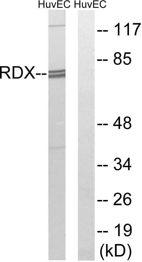 RDX / Radixin Antibody - Western blot analysis of lysates from HUVEC cells, using RDX Antibody. The lane on the right is blocked with the synthesized peptide.