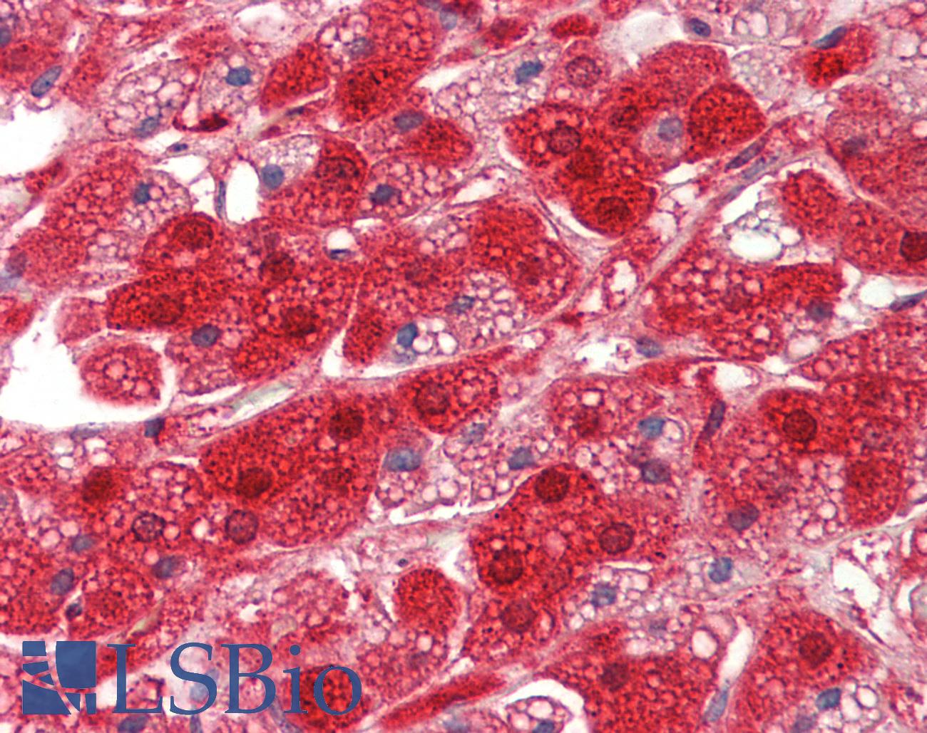 RDX / Radixin Antibody - Anti-RDX / Radixin antibody IHC staining of human adrenal. Immunohistochemistry of formalin-fixed, paraffin-embedded tissue after heat-induced antigen retrieval. Antibody dilution 1:75.