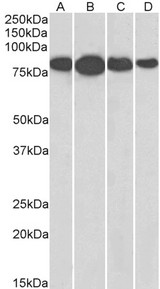 RDX / Radixin Antibody - RDX / Radixin antibody (0.01µg/ml) staining of NIH3T3 (A), HeLa (B), Jurkat (C), and A431 (D) lysates (35µg protein in RIPA buffer). Detected by chemiluminescence.
