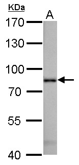 RDX / Radixin Antibody - Radixin antibody detects RDX protein by Western blot analysis. A. 50 ug mouse liver lysate/extract. 7.5 % SDS-PAGE. Radixin antibody dilution:1:1000
