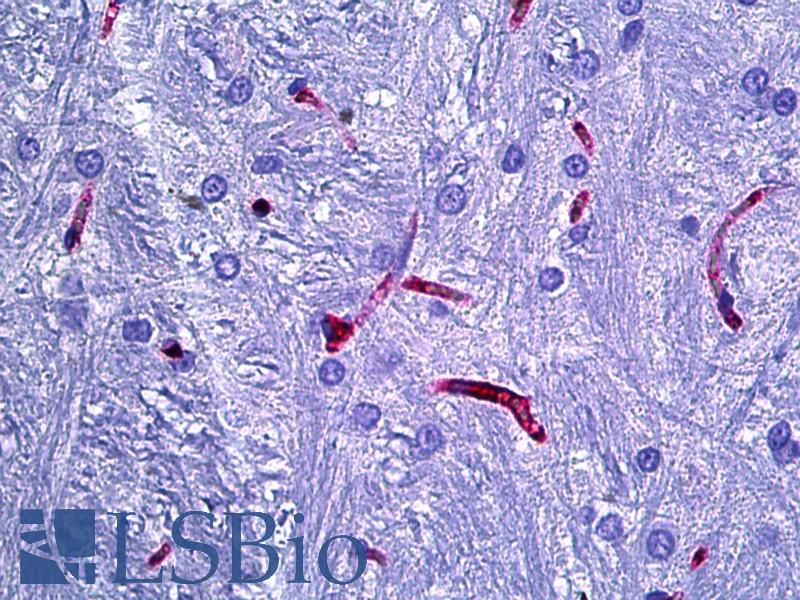 RECA-1 Antibody - Anti-RECA-1 antibody IHC of rat brain, cerebellum vessels. Immunohistochemistry of formalin-fixed, paraffin-embedded tissue after heat-induced antigen retrieval. Antibody concentration 10 ug/ml.