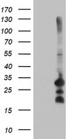 REEP2 Antibody - HEK293T cells were transfected with the pCMV6-ENTRY control (Left lane) or pCMV6-ENTRY REEP2 (Right lane) cDNA for 48 hrs and lysed. Equivalent amounts of cell lysates (5 ug per lane) were separated by SDS-PAGE and immunoblotted with anti-REEP2.