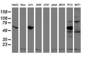 REEP2 Antibody - Western blot of extracts (35ug) from 9 different cell lines by using anti-REEP2 monoclonal antibody.